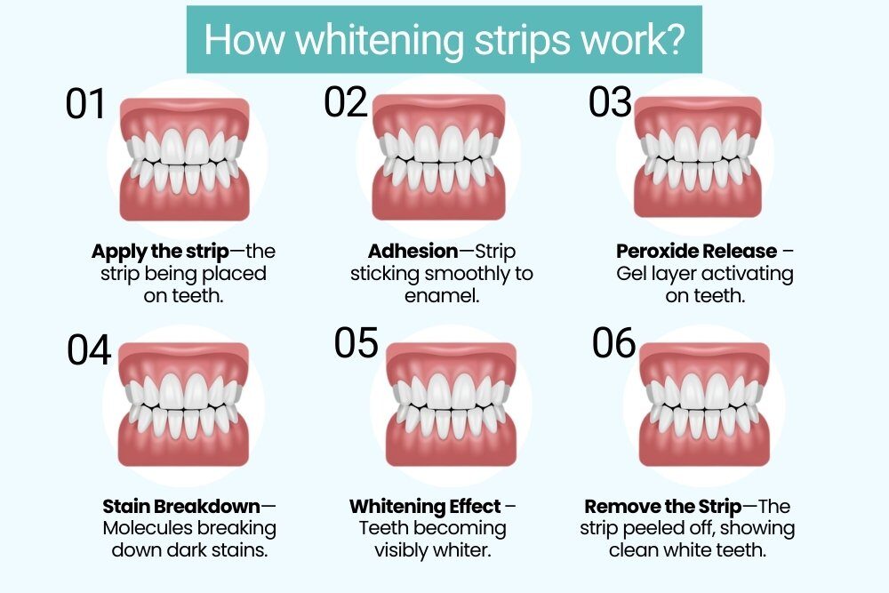 How whitening strips whiten teeth infographic